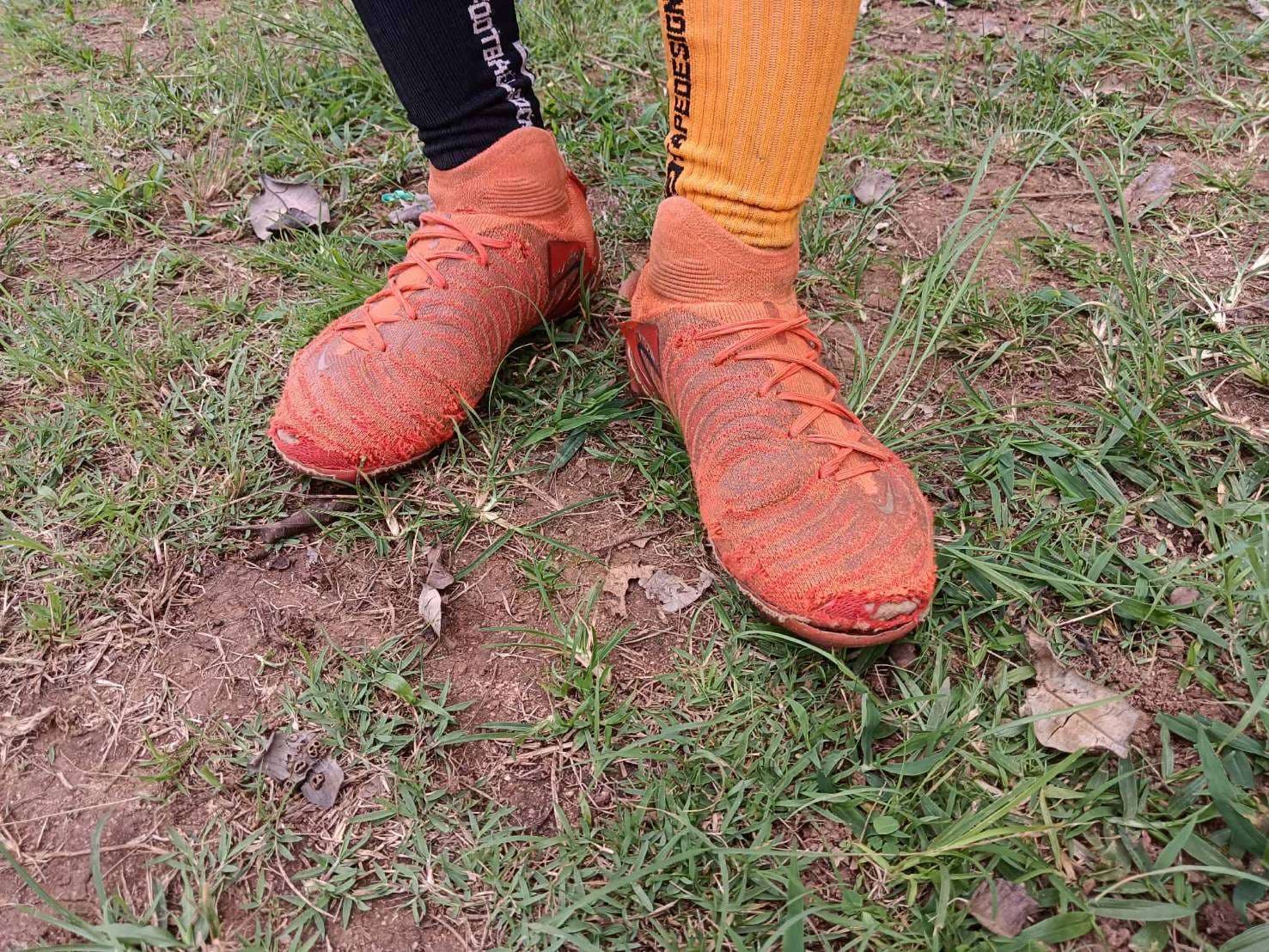 The condition of the children's shoes.