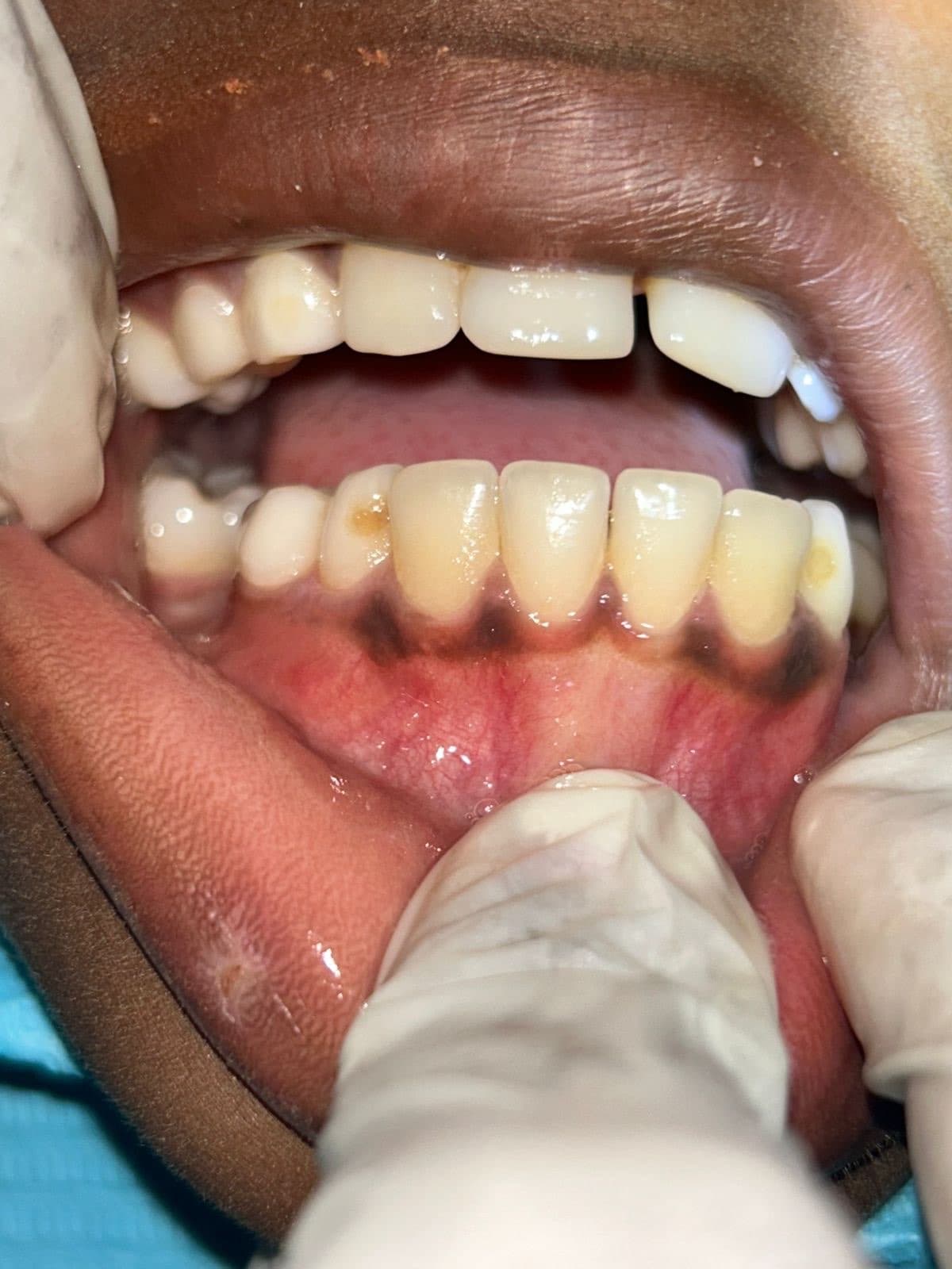 From sugarcane fields to healthy smiles